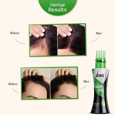 VCare New Improved Herbal Hair Oil with Wonder Cap - 100 ml | 15 Active Herbs Oils for Conditioning, and Hair Fall Control | Ideal For All Types of Hair (Pack of 2)